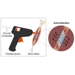 #D bone graft printer glue gun